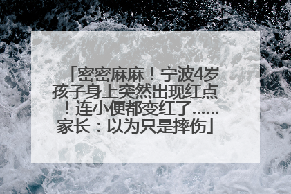 密密麻麻！宁波4岁孩子身上突然出现红点！连小便都变红了……家长：以为只是摔伤